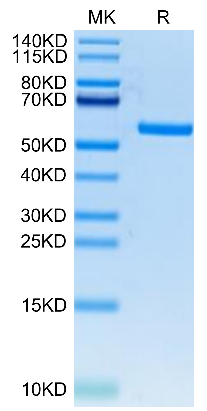 FITC-Labeled Human HLA-A*11:01&B2M&KRAS WT (VVVGAGGVGK) Monomer on Tris-Bis PAGE under reduced condition. The purity is greater than 95%.Recombinant FITC-Labeled Human HLA-A*11:01&B2M&KRAS WT (VVVGAGGVGK) Monomer Protein