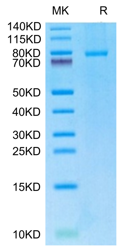 Human CD40 Ligand (Trimer) on Tris-Bis PAGE under reduced condition. The purity is greater than 95%.Recombinant Human CD40 Ligand/TNFSF5 Trimer Protein, Active