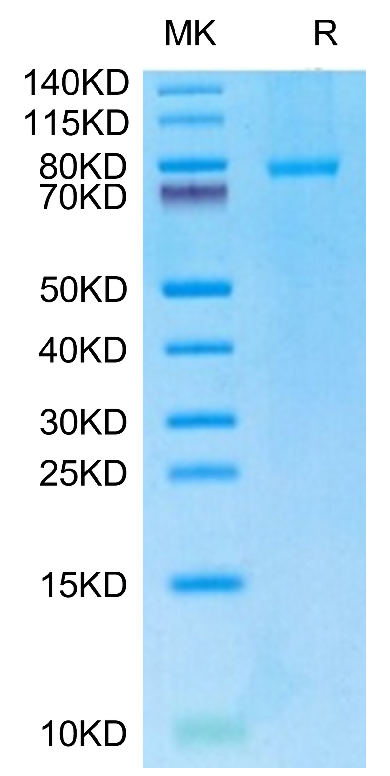 Human CD40 Ligand (Trimer) on Tris-Bis PAGE under reduced condition. The purity is greater than 95%.Recombinant Human CD40 Ligand/TNFSF5 Trimer Protein, Active