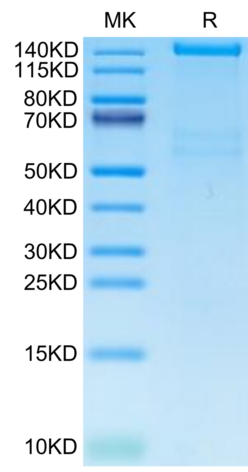 Human PLXNA1 on Tris-Bis PAGE under reduced condition. The purity is greater than 95%.Recombinant Human PLXNA1 Protein