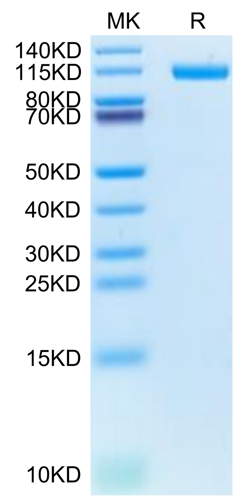 Biotinylated Human CDH17 on Tris-Bis PAGE under reduced condition. The purity is greater than 95%.Biotinylated Human CDH17/Cadherin 17 Protein, Active