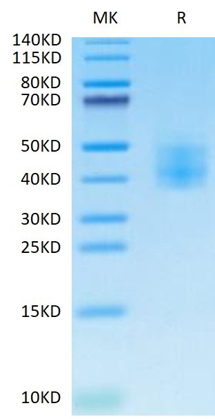 Cynomolgus SLAMF6 on Tris-Bis PAGE under reduced condition. The purity is greater than 95%.Recombinant Cynomolgus SLAMF6/NTB-A Protein
