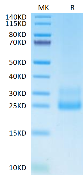 Human CD69 on Tris-Bis PAGE under reduced condition. The purity is greater than 95%.Recombinant Human CD69/CLEC2C Protein