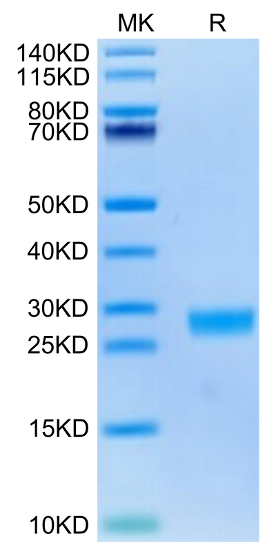 Cynomolgus IL-6 on Tris-Bis PAGE under reduced condition. The purity is greater than 95%.Recombinant Cynomolgus IL-6 Protein, Active