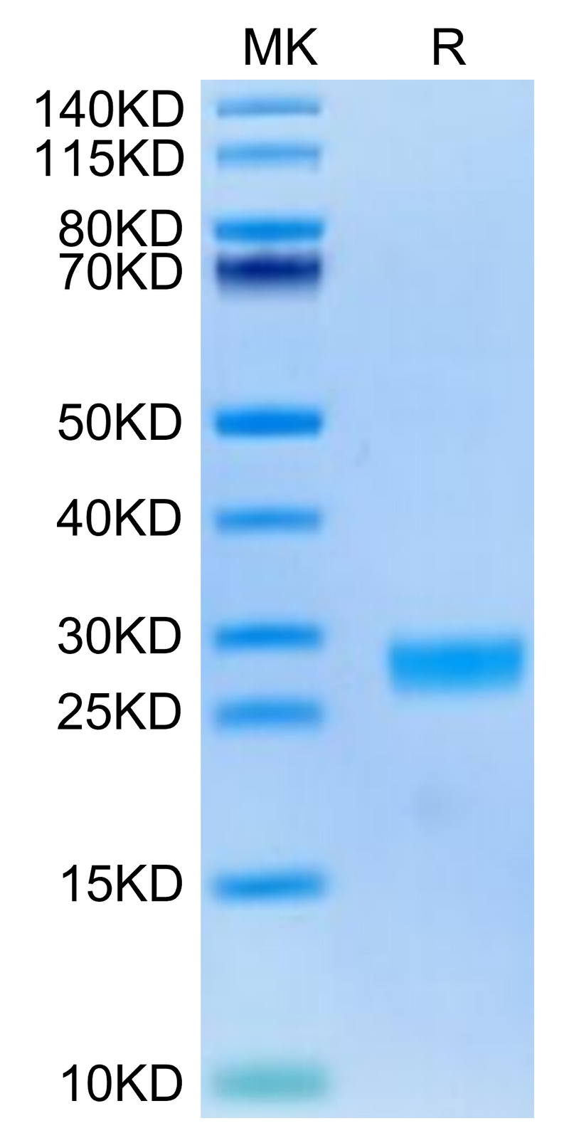 Cynomolgus IL-6 on Tris-Bis PAGE under reduced condition. The purity is greater than 95%.Recombinant Cynomolgus IL-6 Protein, Active