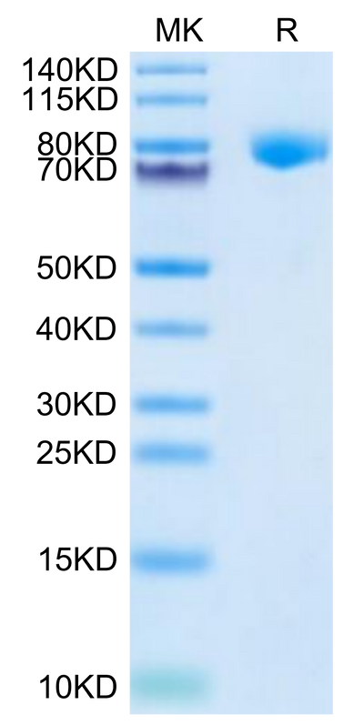 Cynomolgus KLKB1 on Tris-Bis PAGE under reduced condition. The purity is greater than 95%.Recombinant Cynomolgus KLKB1 Protein