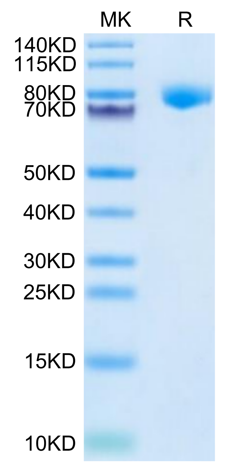 Cynomolgus KLKB1 on Tris-Bis PAGE under reduced condition. The purity is greater than 95%.Recombinant Cynomolgus KLKB1 Protein