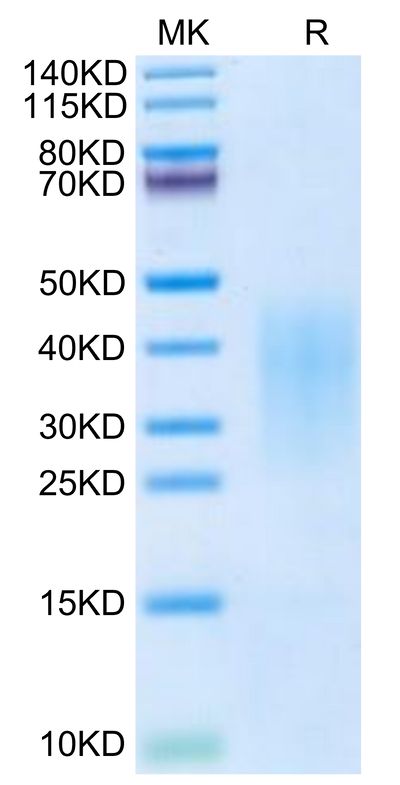 Cynomolgus IL-13 on Tris-Bis PAGE under reduced condition. The purity is greater than 95%.Recombinant Cynomolgus IL-13 Protein, Active