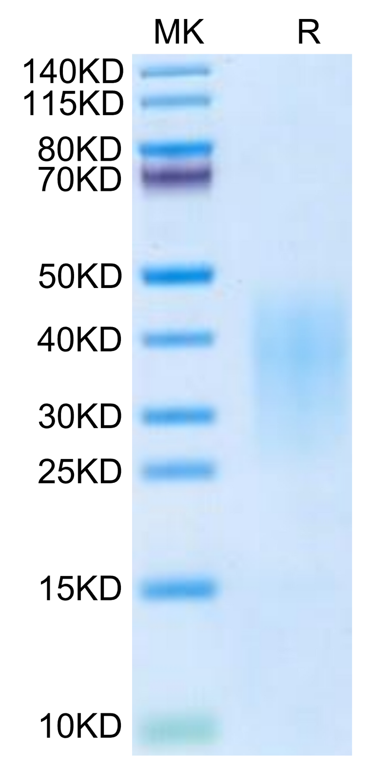 Cynomolgus IL-13 on Tris-Bis PAGE under reduced condition. The purity is greater than 95%.Recombinant Cynomolgus IL-13 Protein, Active