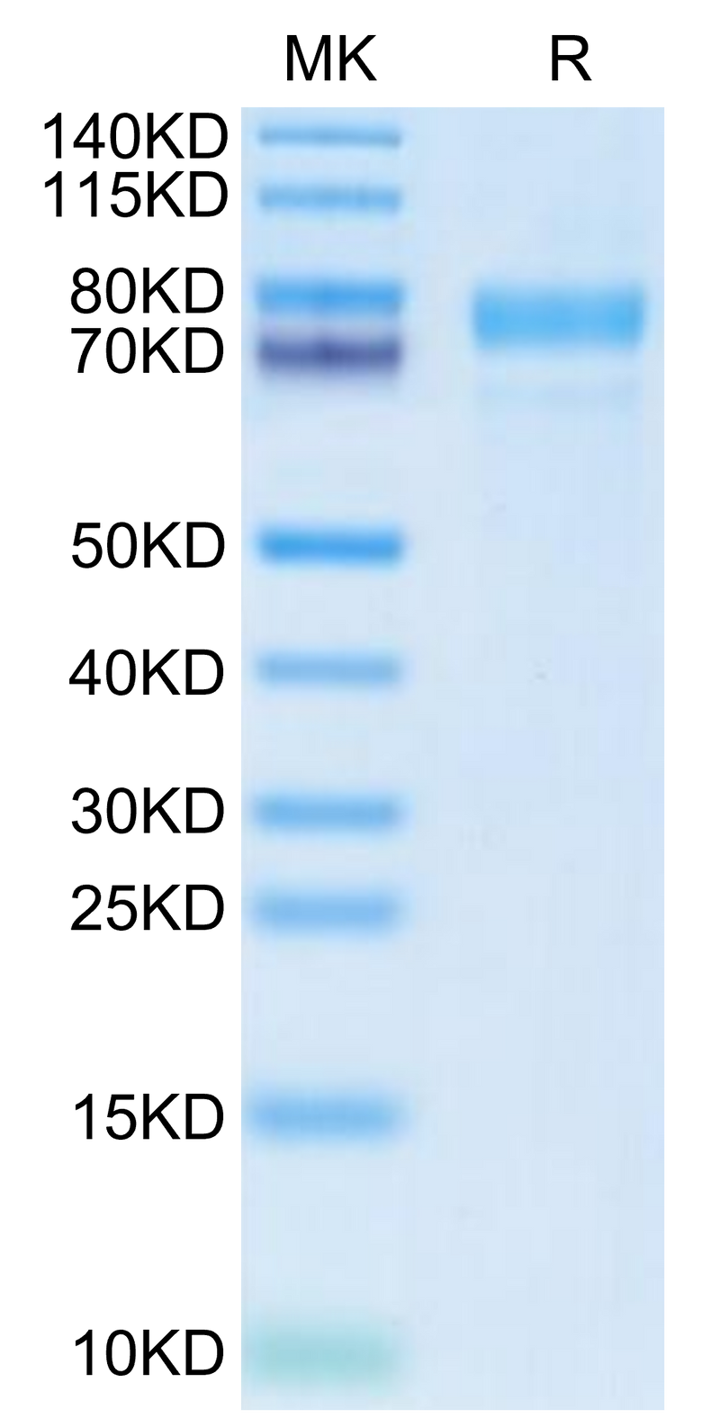Cynomolgus Siglec-10 on Tris-Bis PAGE under reduced condition. The purity is greater than 95%.Recombinant Cynomolgus Siglec-10 Protein, Active