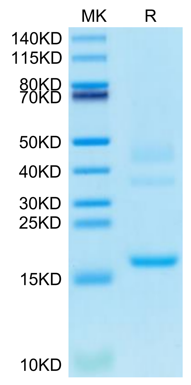 Cynomolgus Transthyretin on Tris-Bis PAGE under reduced condition. The purity is greater than 95%.Recombinant Cynomolgus Transthyretin/Prealbumin Protein