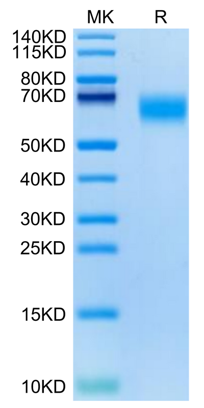 Cynomolgus GM-CSF R alpha on Tris-Bis PAGE under reduced condition. The purity is greater than 95%.Recombinant Cynomolgus GM-CSF R alpha Protein, Active