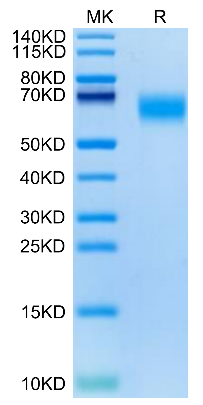 Cynomolgus GM-CSF R alpha on Tris-Bis PAGE under reduced condition. The purity is greater than 95%.Recombinant Cynomolgus GM-CSF R alpha Protein, Active