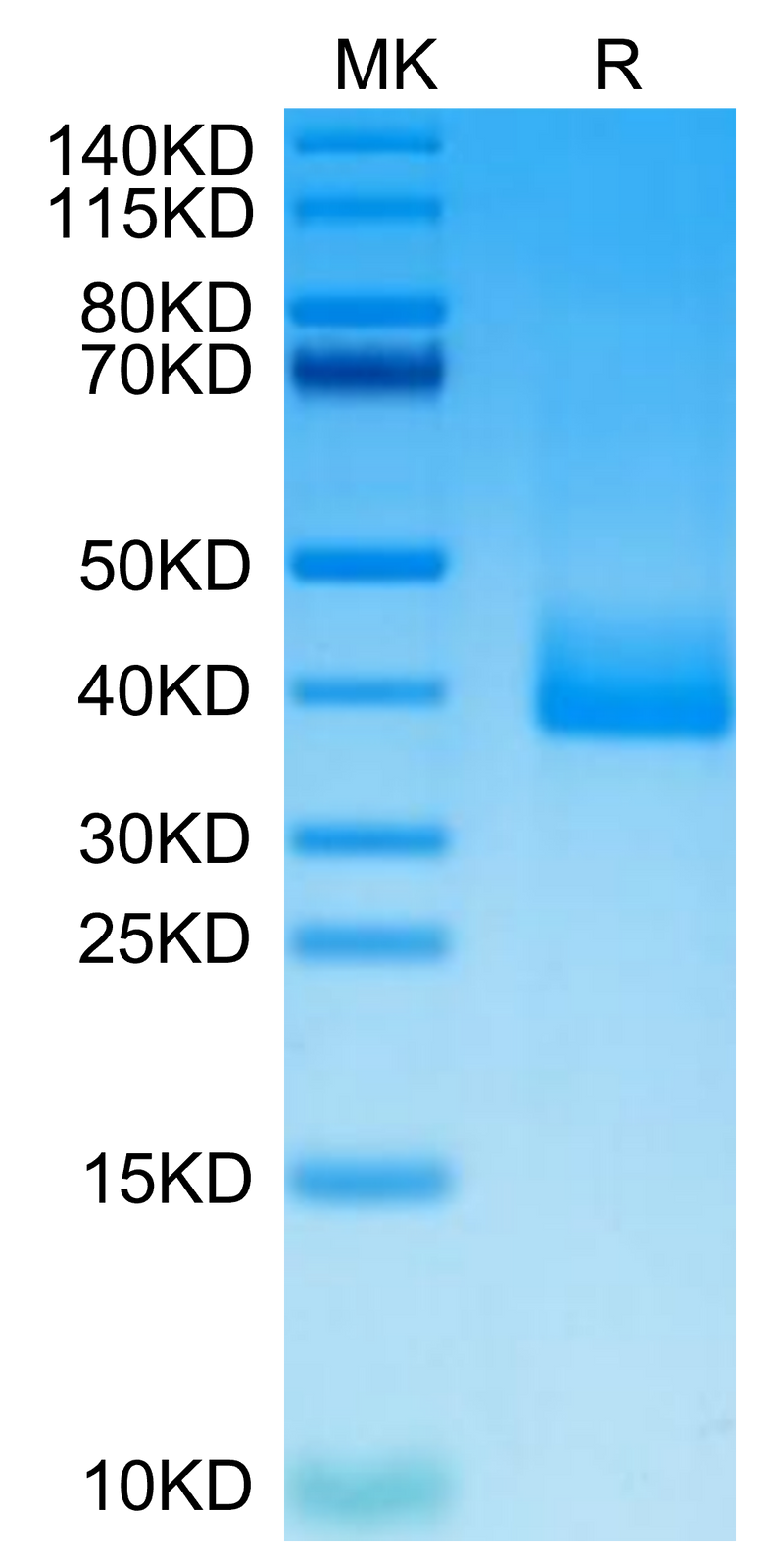 Cynomolgus PRLR on Tris-Bis PAGE under reduced condition. The purity is greater than 95%.Recombinant Cynomolgus PRLR Protein, Active