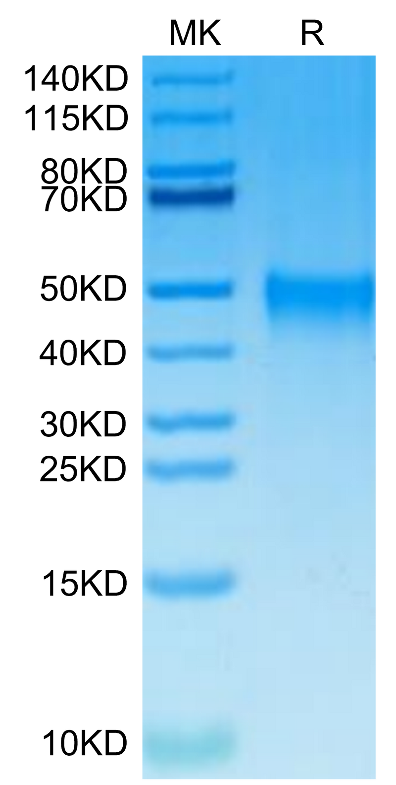 Cynomolgus TSLPR on Tris-Bis PAGE under reduced condition. The purity is greater than 95%.Recombinant Cynomolgus TSLPR Protein, Active