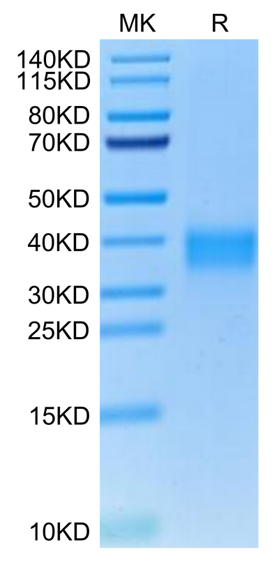 Cynomolgus TNFR1 on Tris-Bis PAGE under reduced condition. The purity is greater than 95%.Recombinant Cynomolgus TNFR1/CD120a/TNFRSF1A Protein, Active
