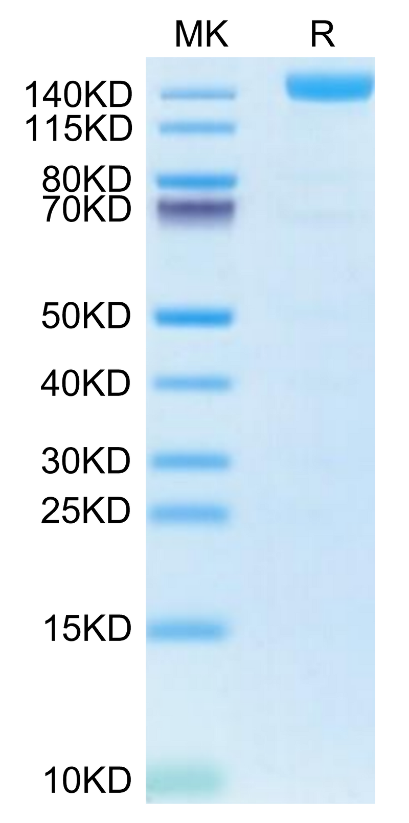 Biotinylated Human VEGF R2 on Tris-Bis PAGE under reduced condition. The purity is greater than 95%.Biotinylated Human VEGF R2/KDR Protein (Primary Amine Labeling), Active