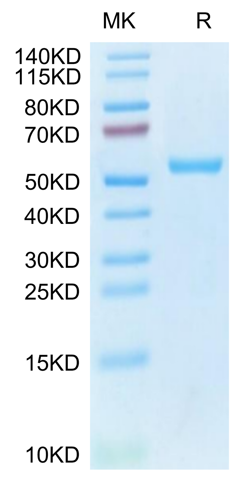 Human HLA-A*02:01&B2M&MAGE-A4 (KVLEHVVRV) Monomer on Tris-Bis PAGE under reduced condition. The purity is greater than 95%.Recombinant Human HLA-A*02:01&B2M&MAGE-A4 (KVLEHVVRV) Monomer Protein