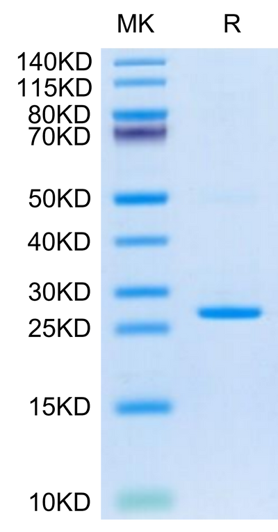 Cynomolgus CRP on Tris-Bis PAGE under reduced condition. The purity is greater than 95%.Recombinant Cynomolgus C-Reactive Protein /CRP Protein