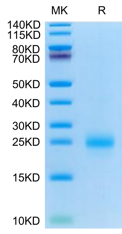 Cynomolgus CD69 on Tris-Bis PAGE under reduced condition. The purity is greater than 95%.Recombinant Cynomolgus CD69/CLEC2C Protein