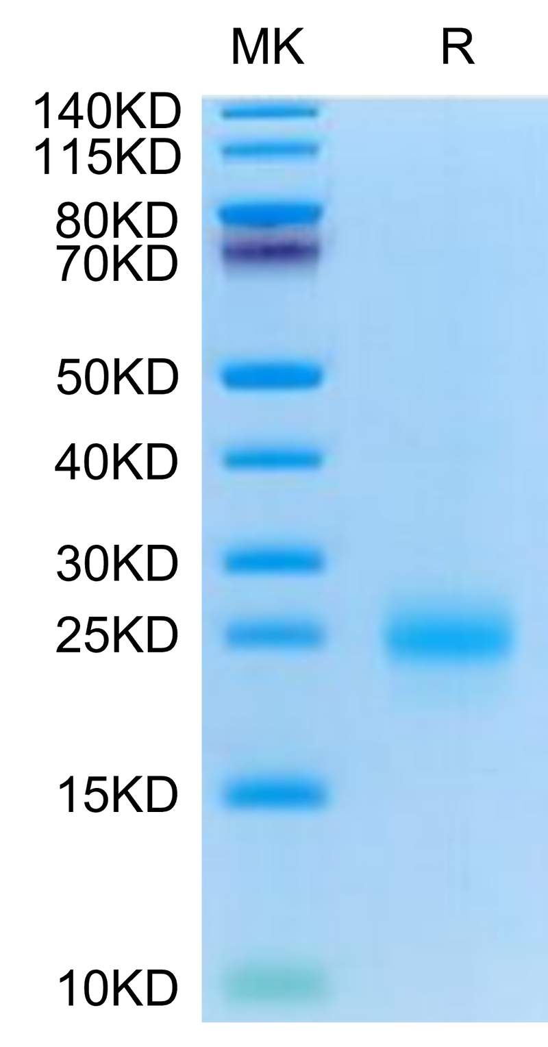 Cynomolgus CD69 on Tris-Bis PAGE under reduced condition. The purity is greater than 95%.Recombinant Cynomolgus CD69/CLEC2C Protein