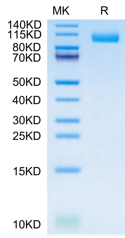 Cynomolgus TLR3 on Tris-Bis PAGE under reduced condition. The purity is greater than 95%.Recombinant Cynomolgus TLR3 Protein