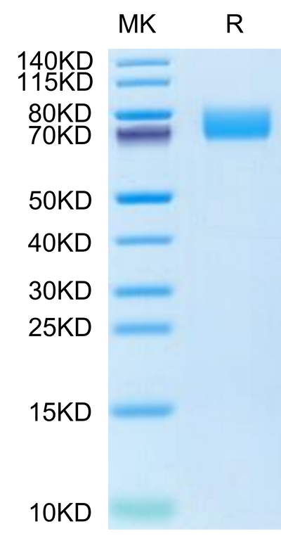 Cynomolgus PDGF R alpha on Tris-Bis PAGE under reduced condition. The purity is greater than 95%.Recombinant Cynomolgus PDGF R alpha/PDGFRA Protein, Active