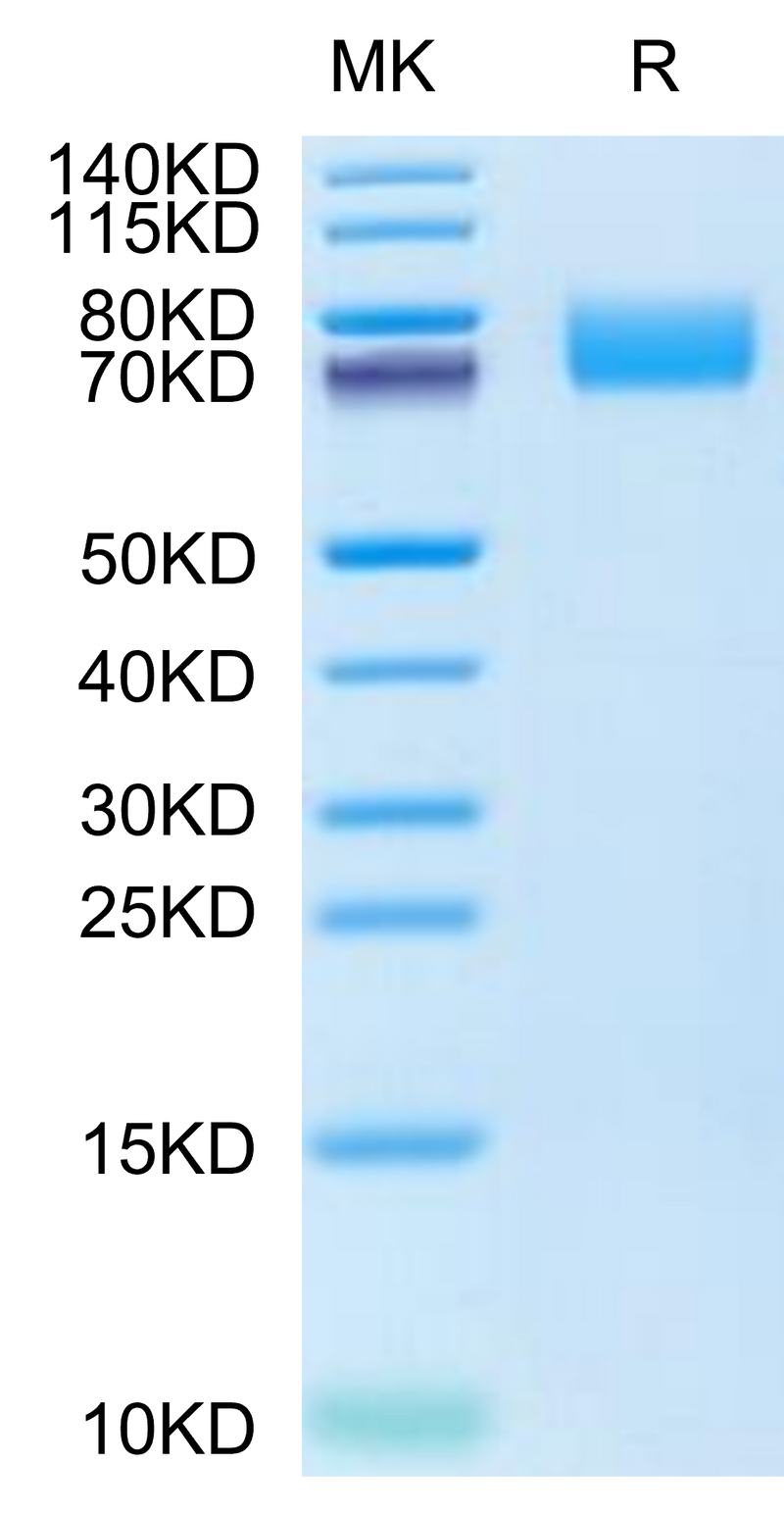 Cynomolgus PDGF R alpha on Tris-Bis PAGE under reduced condition. The purity is greater than 95%.Recombinant Cynomolgus PDGF R alpha/PDGFRA Protein, Active