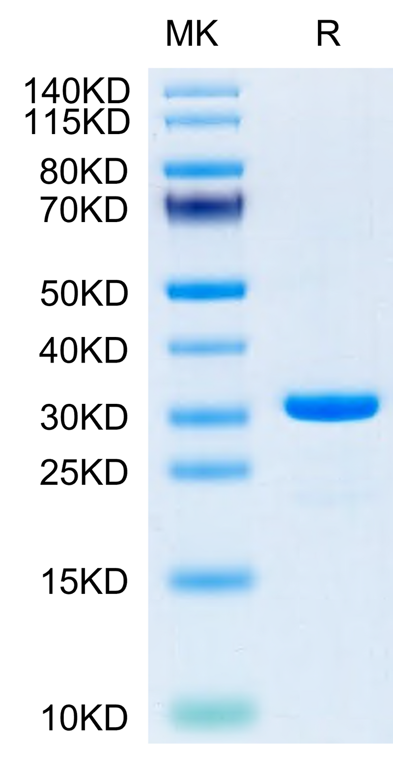 SARS-CoV-2 3CLpro (E166A) on Tris-Bis PAGE under reduced condition. The purity is greater than 95%.Recombinant SARS-CoV-2 3CLpro/3C-like Protease Protein (E166A)