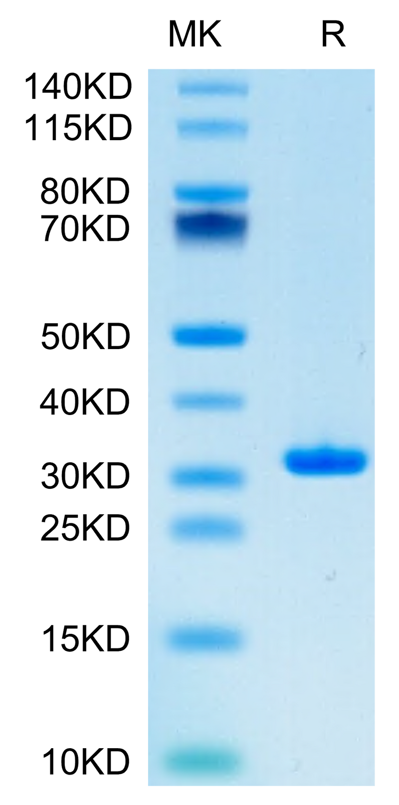 SARS-CoV-2 3CLpro (L167F) on Tris-Bis PAGE under reduced condition. The purity is greater than 95%.Recombinant SARS-CoV-2 3CLpro/3C-like Protease Protein (L167F)