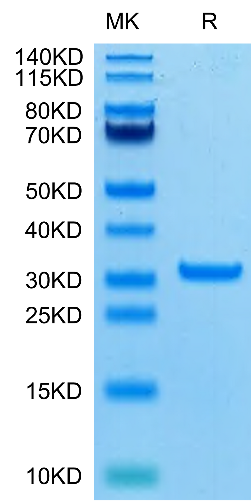 SARS-CoV-2 3CLpro (A191T) on Tris-Bis PAGE under reduced condition. The purity is greater than 95%.Recombinant SARS-CoV-2 3CLpro/3C-like Protease Protein (A191T)