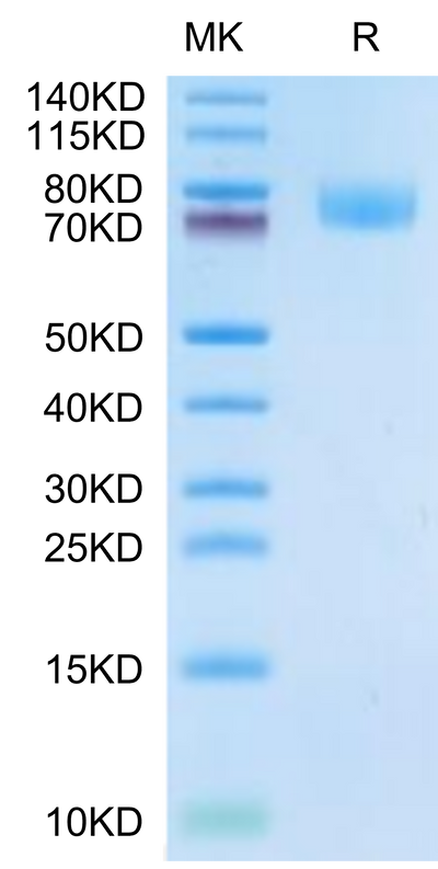 Cynomolgus ALCAM on Tris-Bis PAGE under reduced condition. The purity is greater than 95%.Recombinant Cynomolgus ALCAM/CD166 Protein, Active