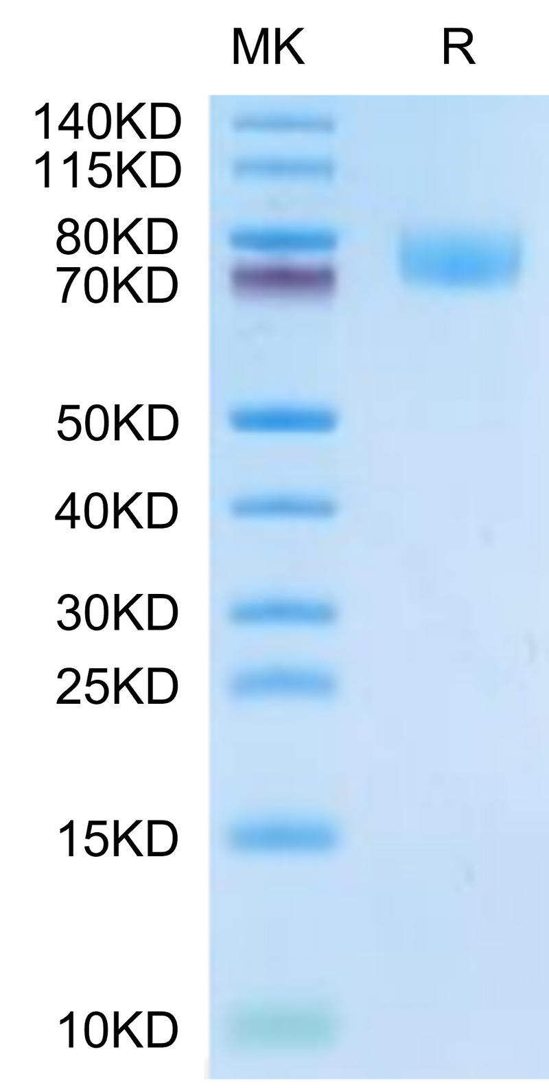 Cynomolgus ALCAM on Tris-Bis PAGE under reduced condition. The purity is greater than 95%.Recombinant Cynomolgus ALCAM/CD166 Protein, Active