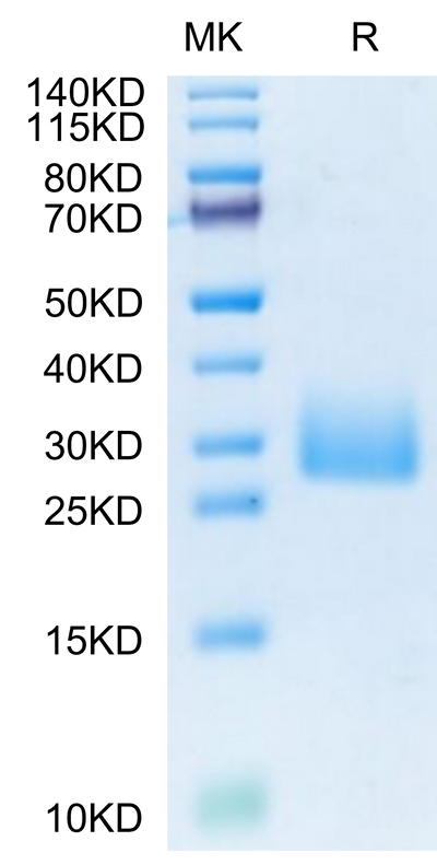 Mouse CD161 on Tris-Bis PAGE under reduced condition. The purity is greater than 95%.Recombinant Mouse CD161 Protein
