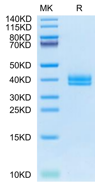 Cynomolgus IGFBP2 on Tris-Bis PAGE under reduced condition. The purity is greater than 95%.Recombinant Cynomolgus IGFBP2 Protein