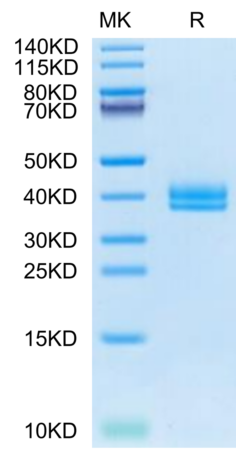Cynomolgus IGFBP2 on Tris-Bis PAGE under reduced condition. The purity is greater than 95%.Recombinant Cynomolgus IGFBP2 Protein