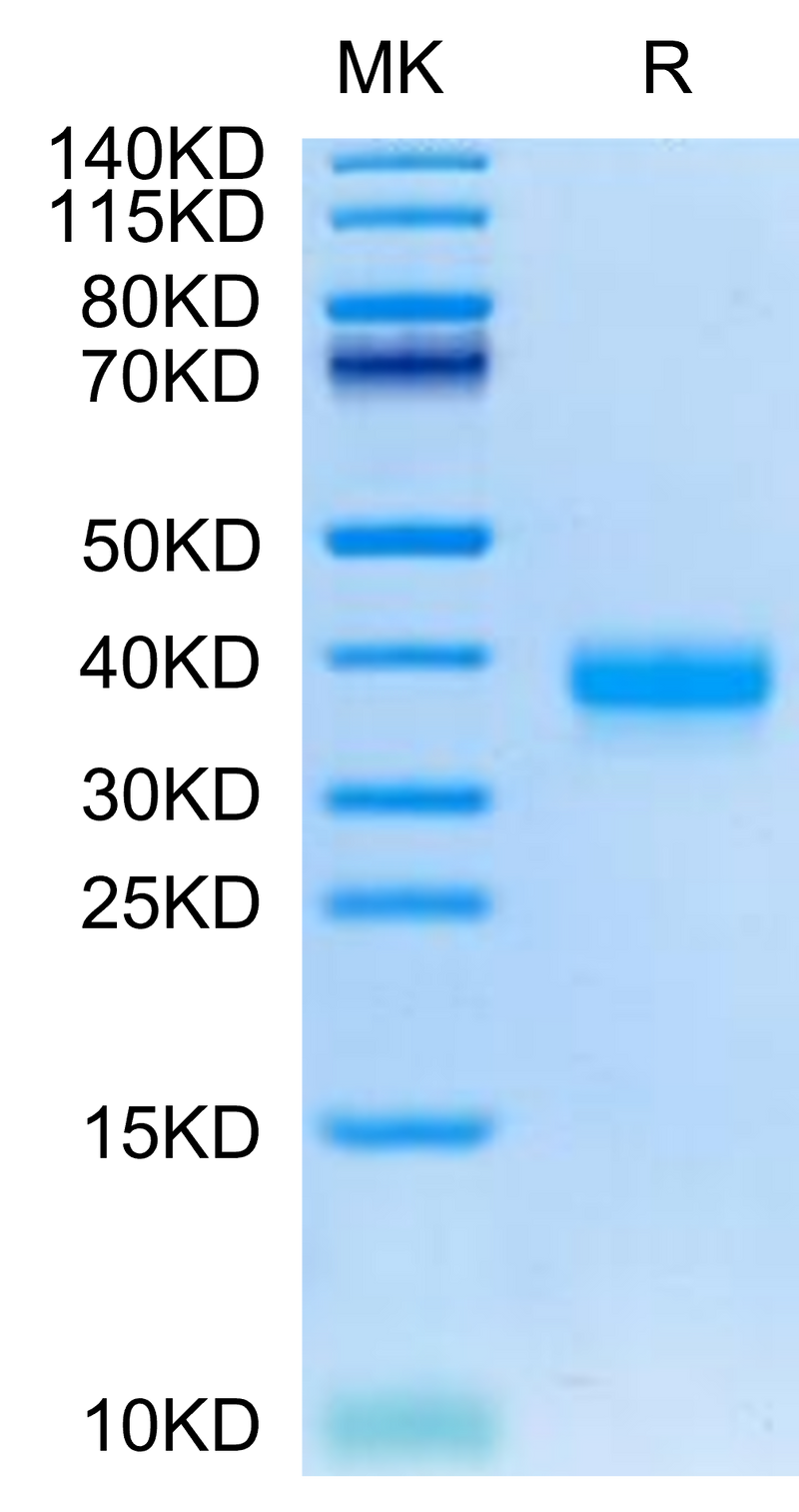Cynomolgus ANGPTL4 on Tris-Bis PAGE under reduced condition. The purity is greater than 95%.Recombinant Cynomolgus ANGPTL4/Angiopoietin-like 4 Protein