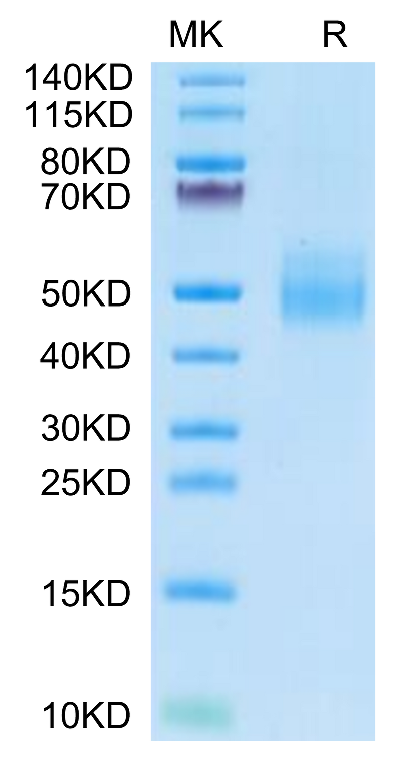 Cynomolgus IL-10 R alpha on Tris-Bis PAGE under reduced condition. The purity is greater than 95%.Recombinant Cynomolgus IL-10 R alpha Protein, Active