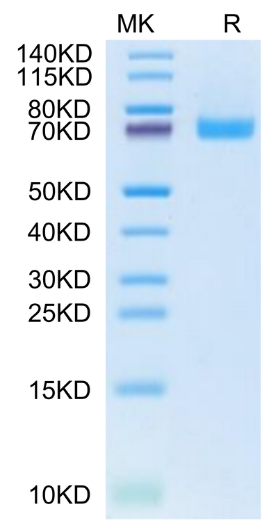 Cynomolgus EPHB2 on Tris-Bis PAGE under reduced condition. The purity is greater than 95%.Recombinant Cynomolgus EPHB2 Protein, Active