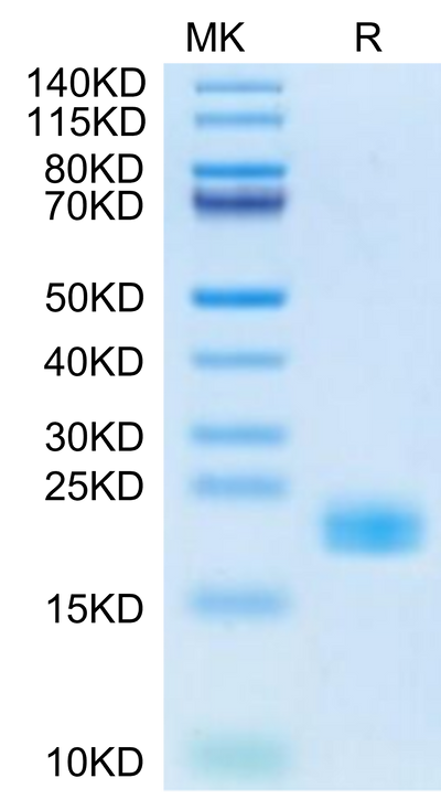 Cynomolgus IL-11 on Tris-Bis PAGE under reduced condition. The purity is greater than 95%.Recombinant Cynomolgus IL-11 Protein, Active