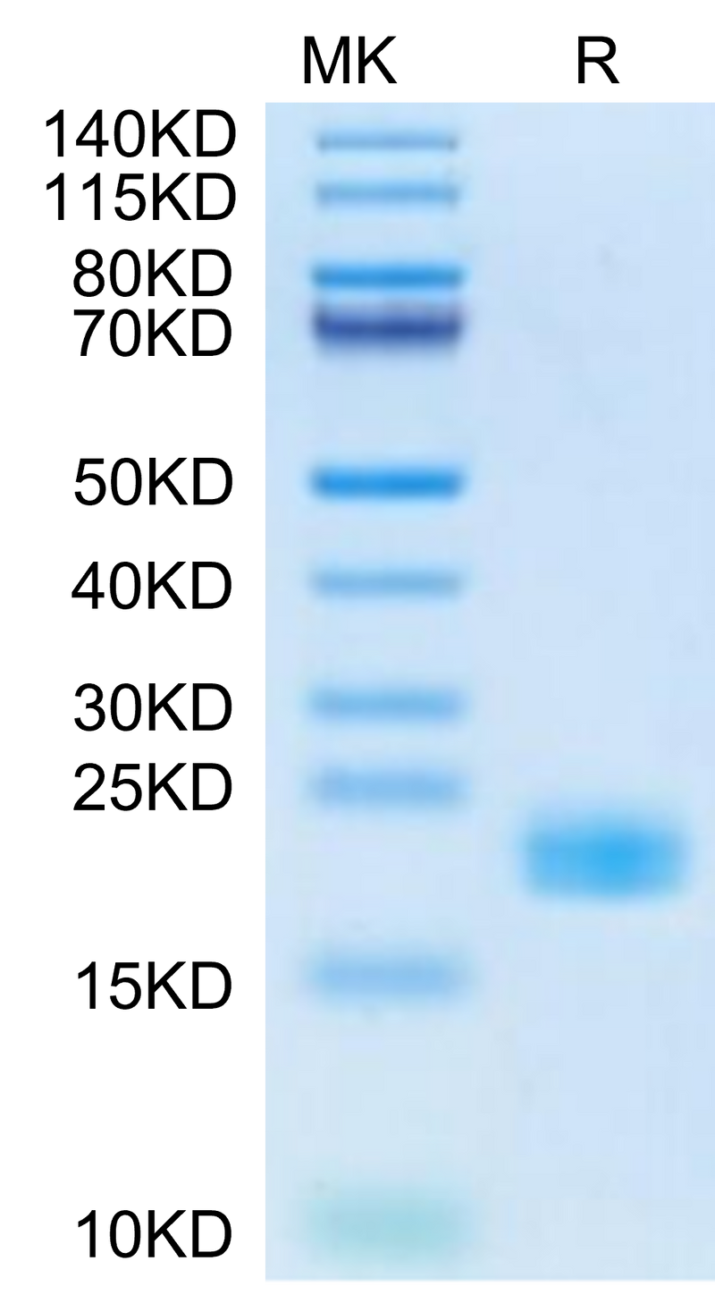 Cynomolgus IL-11 on Tris-Bis PAGE under reduced condition. The purity is greater than 95%.Recombinant Cynomolgus IL-11 Protein, Active