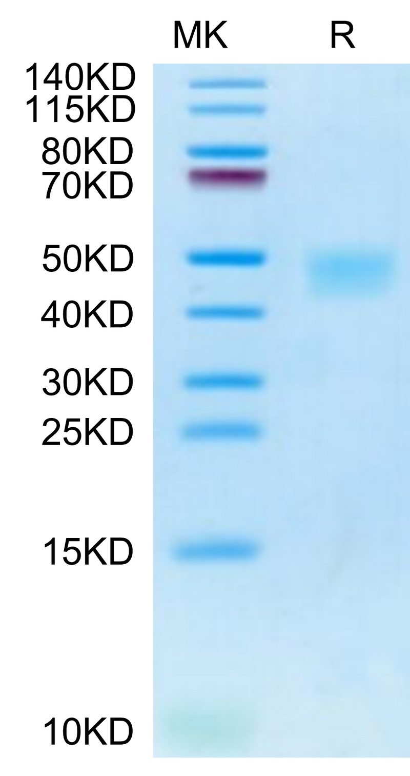 Cynomolgus IL-21R on Tris-Bis PAGE under reduced condition. The purity is greater than 95%.Recombinant Cynomolgus IL-21R Protein, Active