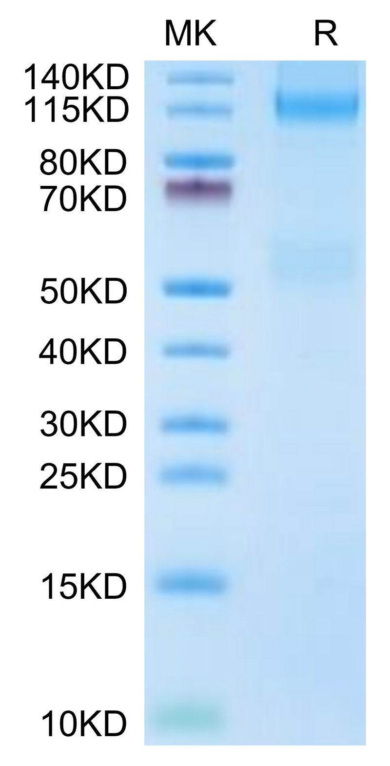 Mouse IGF1R on Tris-Bis PAGE under reduced condition. The purity is greater than 95%.Recombinant Mouse IGF1R/CD221 Protein, Active