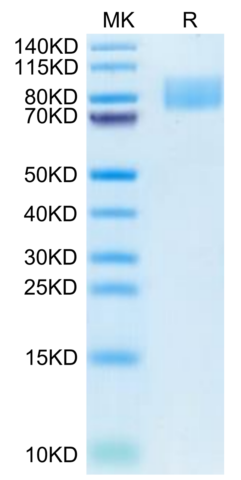 Cynomolgus ICAM-1 on Tris-Bis PAGE under reduced condition. The purity is greater than 95%.Recombinant Cynomolgus ICAM-1/CD54 Protein