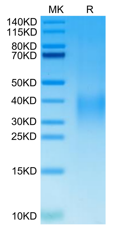 Cynomolgus GPA on Tris-Bis PAGE under reduced condition. The purity is greater than 95%.Recombinant Cynomolgus GPA Protein