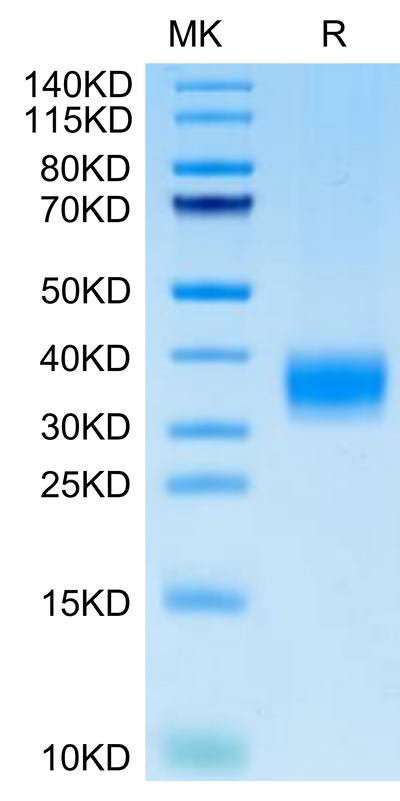 Cynomolgus LAMP5 on Tris-Bis PAGE under reduced condition. The purity is greater than 95%.Recombinant Cynomolgus LAMP5 Protein