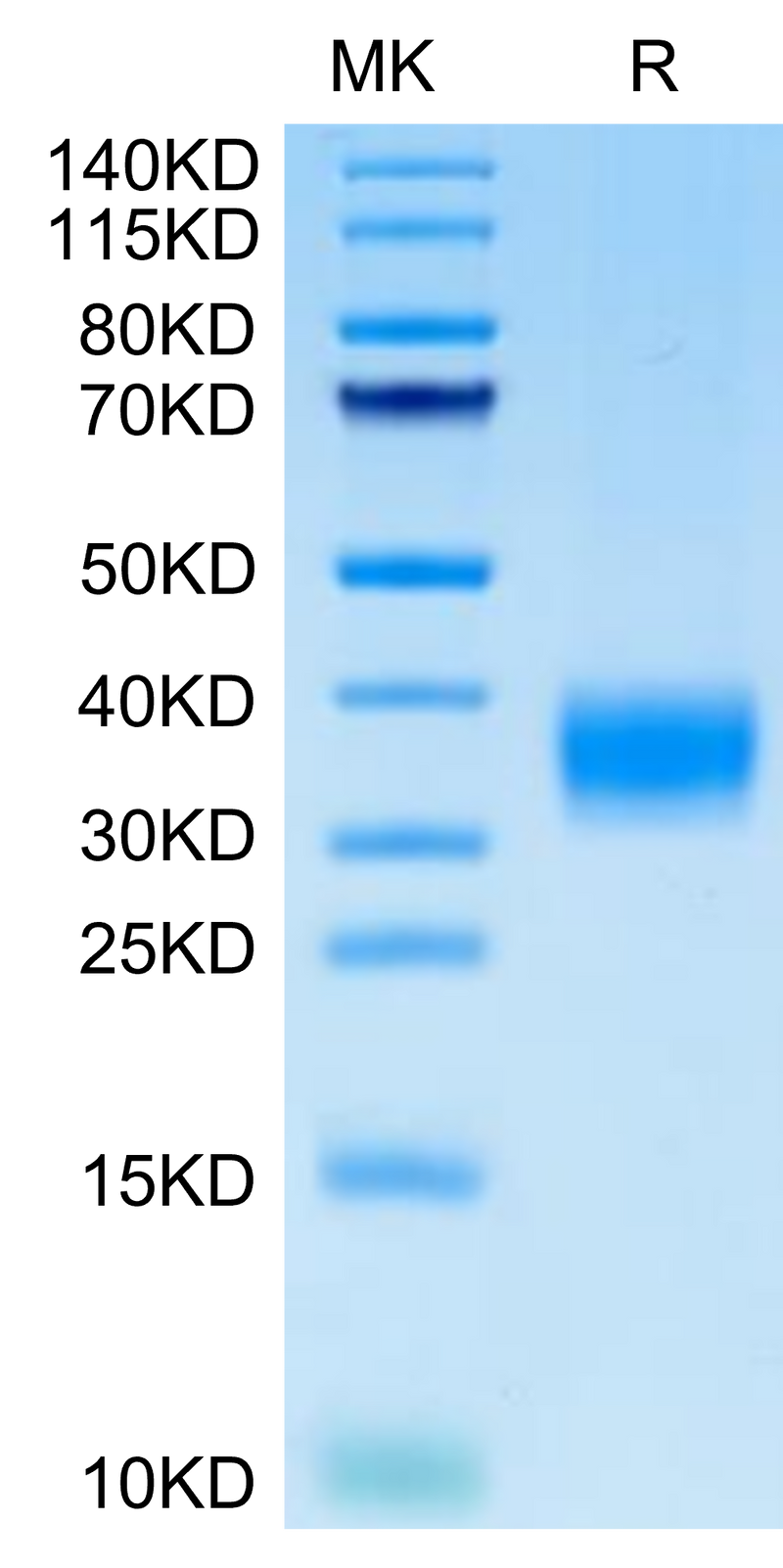 Cynomolgus LAMP5 on Tris-Bis PAGE under reduced condition. The purity is greater than 95%.Recombinant Cynomolgus LAMP5 Protein