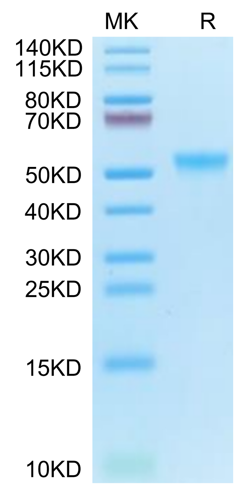 Cynomolgus GPVI on Tris-Bis PAGE under reduced condition. The purity is greater than 95%.Recombinant Cynomolgus GPVI Protein, Active