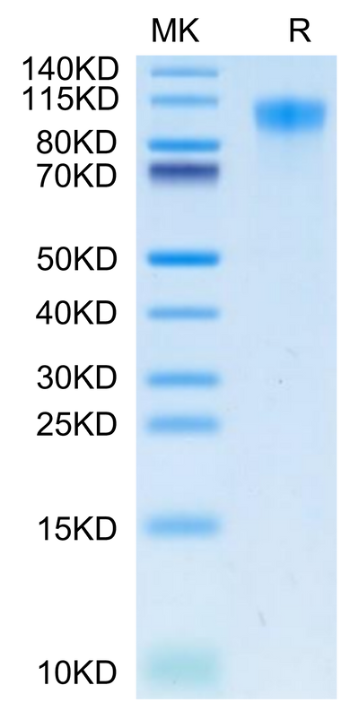 Human TIM-1 on Tris-Bis PAGE under reduced condition. The purity is greater than 95%.Recombinant Human TIM-1/HAVCR1 Protein