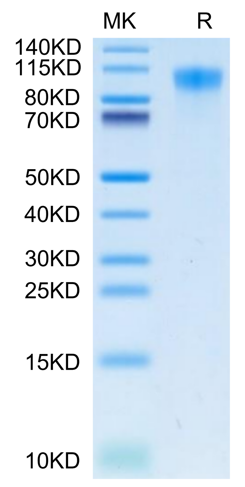 Human TIM-1 on Tris-Bis PAGE under reduced condition. The purity is greater than 95%.Recombinant Human TIM-1/HAVCR1 Protein